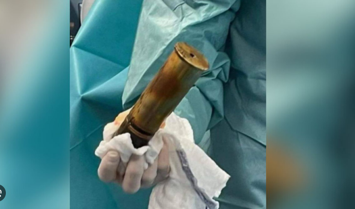 obús en Francia recto