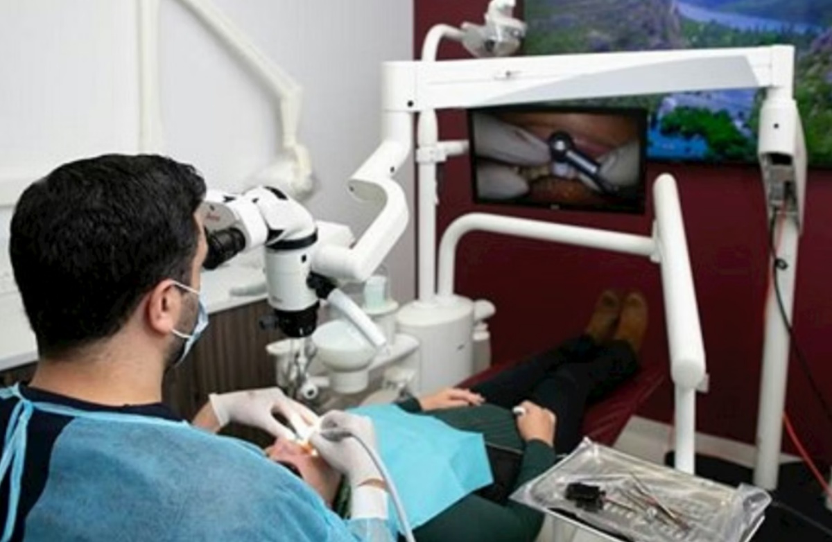 Equipos de endodoncia: innovación y precisión en la odontología moderna