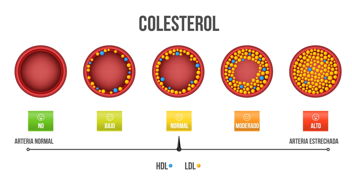 colwesterol bueno y malo