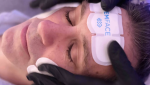El protocolo que está redefiniendo el rejuvenecimiento facial: Bioever Skin